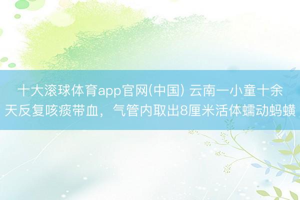 十大滚球体育app官网(中国) 云南一小童十余天反复咳痰带血,气管内取出8厘米活体蠕动蚂蟥